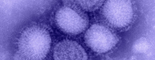 This is swine flu: a cluster of H1N1 viruses as seen through an electron scanning microscope. Image courtesy of the U.S. Centres for Disease Control