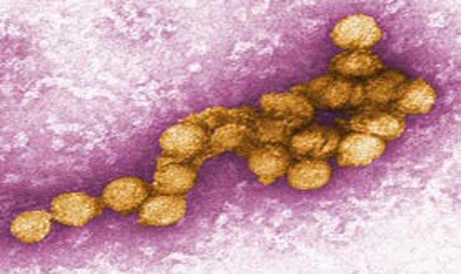 The West Nile Virus. Electron Microscope photo courtesy of the BC Centres for Disease Control