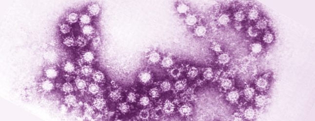 Enterovirus D68 (EV-D68), the virus responsible for a rash of infections among young children in the United States, BC, Alberta and Ontario has appeared in one community within the Interior Health Authority. Medical Health Officer Dr. Trevor Corneil confirmed the appearance of one case in a community within the IHA’s Thompson Cariboo Shuswap region. He would not name the community but said the existence of this case does not constitute a risk to public health, which would require naming the town. There is no cause for alarm, he said, adding that there are currently 8 known cases of the virus in this province. US Centres for Disease Control photo