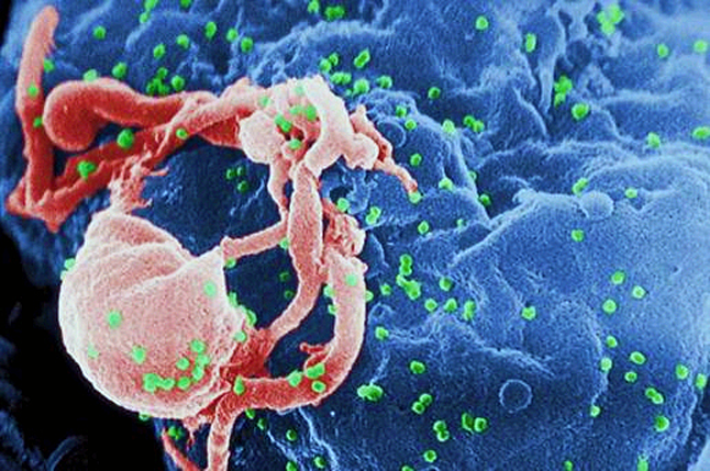 The First Nations Health Authority (FNHA) is partnering with Interior Health on a campaign that aims to destigmatize HIV and AIDS and encourage all First Nations and Aboriginal peoples, along with all other sexually active adults in the region, to get an HIV test. This image from the US Centres for Disease Control is a scanning electron micrograph of HIV-1 budding from a cultured lymphocyte. US Centres for Disease Control image